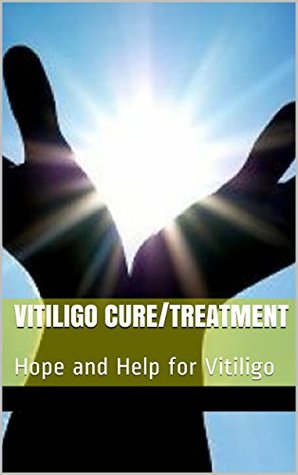 Read online Vitiligo Cure/Treatment: Hope and Help for Vitiligo - Jane Teesdale | ePub