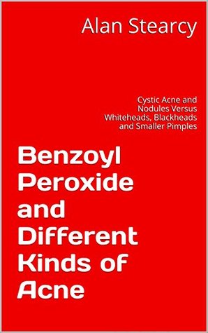 Read online Benzoyl Peroxide and Different Kinds of Acne: Cystic Acne and Nodules Versus Whiteheads, Blackheads and Smaller Pimples - Alan Stearcy file in ePub