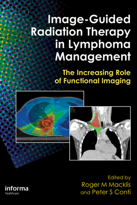 Read Online Image-Guided Radiation Therapy in Lymphoma Management: The Increasing Role of Functional Imaging - Roger M Macklis | PDF